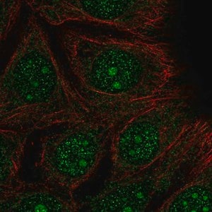 Merck Anti-DEGS2 antibody produced in rabbit
