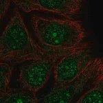 Merck Anti-DEGS2 antibody produced in rabbit