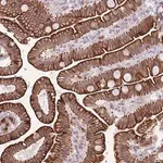 Merck Anti-MEIS3 antibody produced in rabbit