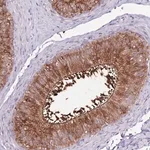Merck Anti-ZSWIM1 antibody produced in rabbit