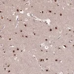 Merck Anti-ST5 antibody produced in rabbit