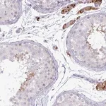 Merck Anti-IRGC antibody produced in rabbit