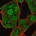 Merck Anti-C17ORF100 antibody produced in rabbit