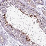 Merck Anti-PLCXD3 antibody produced in rabbit