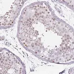 Merck Anti-REXO4 antibody produced in rabbit