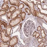 Merck Anti-SLC16A4 antibody produced in rabbit