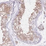 Merck Anti-RPL39L antibody produced in rabbit