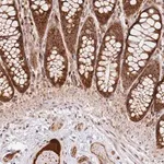 Merck Anti-SMOX antibody produced in rabbit