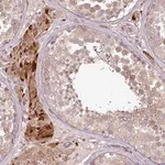 Merck Anti-PDRG1 antibody produced in rabbit