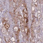 Merck Anti-TNFRSF6B antibody produced in rabbit