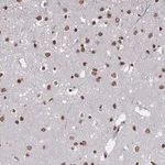 Merck Anti-PLEKHG5 antibody produced in rabbit