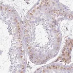 Merck Anti-ANKRD53 antibody produced in rabbit