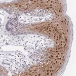 Merck Anti-ZNF142 antibody produced in rabbit