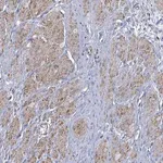 Merck Anti-PAPSS1 antibody produced in rabbit