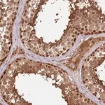 Merck Anti-PLSCR5 antibody produced in rabbit