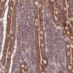 Merck Anti-SLC35B4 antibody produced in rabbit