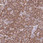 Merck Anti-MRPL30 antibody produced in rabbit