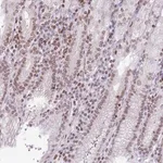 Merck Anti-RRNAD1 antibody produced in rabbit