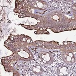 Merck Anti-CCDC71 antibody produced in rabbit