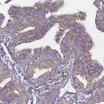 Merck Anti-CCDC13 antibody produced in rabbit