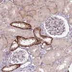 Merck Anti-TRMT10A antibody produced in rabbit