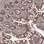 Merck Anti-TMEM176B antibody produced in rabbit