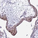 Merck Anti-POP5 antibody produced in rabbit