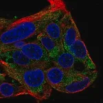 Merck Anti-FBXL22 antibody produced in rabbit