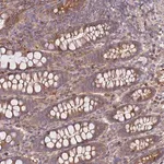 Merck Anti-REM1 antibody produced in rabbit