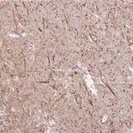 Merck Anti-EPN2 antibody produced in rabbit