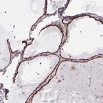 Merck Anti-MAGT1 antibody produced in rabbit