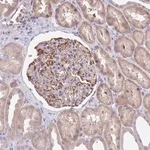 Merck Anti-ZNF14 antibody produced in rabbit