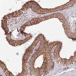Merck Anti-MOGAT1 antibody produced in rabbit
