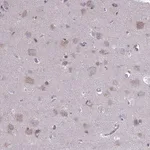 Merck Anti-PET117 antibody produced in rabbit