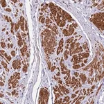 Merck Anti-PLEKHH1 antibody produced in rabbit