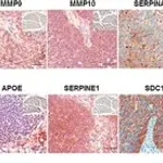 Merck Anti-SERPINE1 antibody produced in rabbit