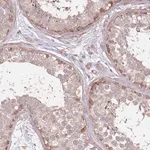 Merck Anti-SPATA31D1 antibody produced in rabbit