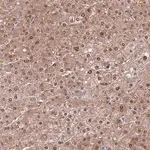 Merck Anti-SEPHS2 antibody produced in rabbit