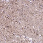 Merck Anti-PIP4K2B antibody produced in rabbit