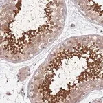 Merck Anti-TBX10 antibody produced in rabbit