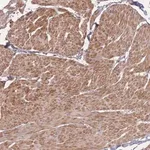Merck Anti-BST1 antibody produced in rabbit