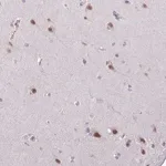 Merck Anti-YLPM1 antibody produced in rabbit
