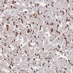 Merck Anti-MUM1 antibody produced in rabbit
