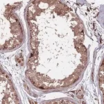 Merck Anti-METTL10 antibody produced in rabbit