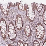 Merck Anti-DCHS1 antibody produced in rabbit