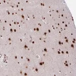 Merck Anti-CHERP antibody produced in rabbit