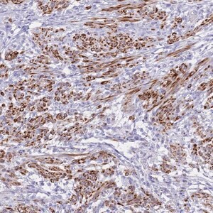 Merck Anti-KCTD15 antibody produced in rabbit