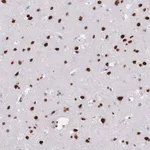 Merck Anti-SAFB2 antibody produced in rabbit