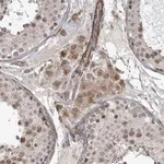 Merck Anti-SBF2 antibody produced in rabbit