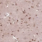Merck Anti-GDPGP1 antibody produced in rabbit